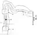 Fig. 83 - Method and apparatus for manipulating the side wall of a body lumen or body cavity so as to provide increased visualization of the same and/or increased access to the same, and/or for stabilizing instruments relative to the same