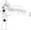 Fig. 84 - Method and apparatus for manipulating the side wall of a body lumen or body cavity so as to provide increased visualization of the same and/or increased access to the same, and/or for stabilizing instruments relative to the same
