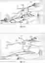Fig. 07 - METHODS AND APPARATUS FOR A CLEANING SHEATH FOR AN ENDOSCOPE