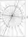Fig. 02 - Intraocular lens alignment