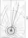Fig. 03 - Intraocular lens alignment