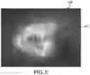 Fig. 06 - Volume analysis and display of information in optical coherence tomography angiography