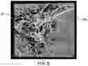 Fig. 09 - Volume analysis and display of information in optical coherence tomography angiography