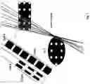 Fig. 08 - Optimal deep brain stimulation electrode selection and placement on the basis of stimulation field modelling