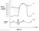Fig. 05 - APPARATUS AND METHOD FOR CALCULATING BLOOD PRESSURE USING DIGITAL ECG VOLTAGE COORDINATE VALUES