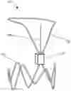 Fig. 01 - Implantable intravascular sensing device