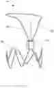 Fig. 07 - Implantable intravascular sensing device