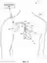 Fig. 02 - USING MULTIPLE DIAGNOSTIC PARAMETERS FOR PREDICTING HEART FAILURE EVENTS