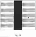 Fig. 03 - System and method for next-generation MRI spine evaluation