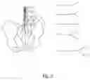 Fig. 05 - System and method for next-generation MRI spine evaluation