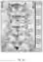 Fig. 08 - System and method for next-generation MRI spine evaluation