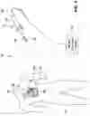 Fig. 02 - Localized magnetic field generator