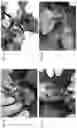 Fig. 02 - Body fluid leakage detection aqueous composition