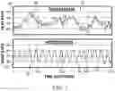 Fig. 02 - SYSTEM AND METHOD TO DETERMINE HEART RATE VARIABILITY COHERENCE INDEX