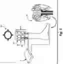 Fig. 06 - Feedback device with stimulation of sensory nerves for improved balance control