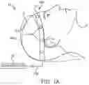 Fig. 02 - Connection quality assessment for EEG electrode arrays