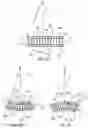 Fig. 04 - Variable focus X-ray anti scatter device
