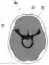 Fig. 01 - Medical image processing apparatus, method, and program