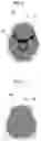 Fig. 04 - Medical image processing apparatus, method, and program
