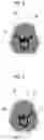 Fig. 05 - Medical image processing apparatus, method, and program