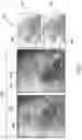 Fig. 08 - Visualizing a course of a vasculature structure with an occlusion