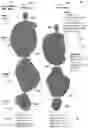 Fig. 01 - Computer-assisted tumor response assessment and evaluation of the vascular tumor burden