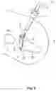Fig. 06 - Four bar articulation mechanism for tissue specimen retrieval device