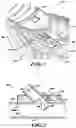 Fig. 02 - Partial eversion anastomosis juncture formation and suturing