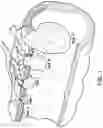 Fig. 02 - Devices, systems, and methods for tissue resection