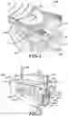 Fig. 02 - Full eversion anastomosis juncture formation and suturing