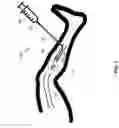 Fig. 08 - METHODS AND APPARATUS FOR TREATING VEINS
