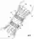 Fig. 09 - Full-circumferential tissue resectioning