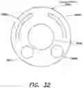 Fig. 53 - Mechanisms for controlling rotation of outer cannula for use in endoscopic tool