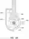 Fig. 66 - Mechanisms for controlling rotation of outer cannula for use in endoscopic tool