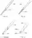 Fig. 08 - Tissue incision device