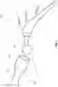 Fig. 08 - Bone preparation apparatus and method