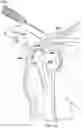 Fig. 17 - Surgical device deployment apparatuses