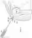 Fig. 39 - Surgical device deployment apparatuses