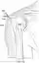 Fig. 40 - Surgical device deployment apparatuses