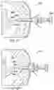 Fig. 44 - Surgical device deployment apparatuses
