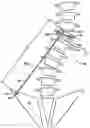Fig. 01 - Device and method for treatment of spinal deformity