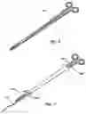 Fig. 06 - Device and method for treatment of spinal deformity