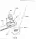 Fig. 07 - Device and method for treatment of spinal deformity