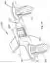 Fig. 09 - Device and method for treatment of spinal deformity