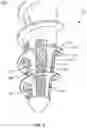 Fig. 06 - Bone screw and method of manufacture