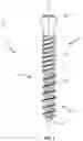 Fig. 02 - Bone screw and method of manufacture