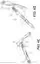 Fig. 09 - Systems and methods for intramedullary nail implantation