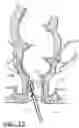 Fig. 13 - Medical ablation devices and methods
