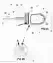Fig. 04 - Single-use, low cost exothermic system for thermocoagulation of tissue