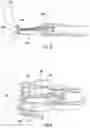 Fig. 09 - Endoscopic full thickness resection device
